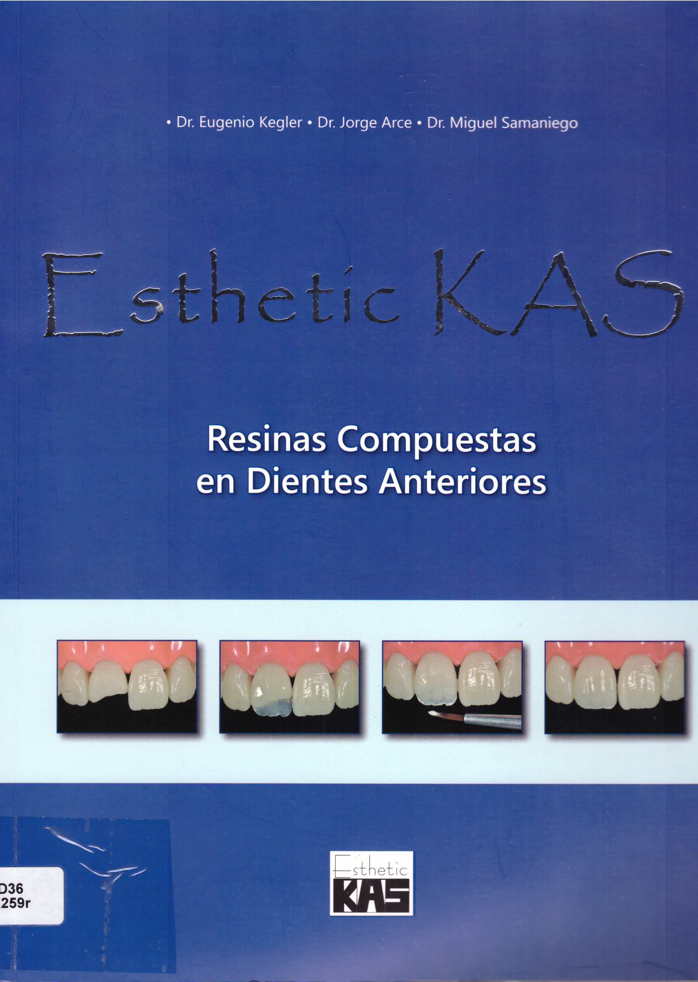 resinas compuestas en dientes anteriores
